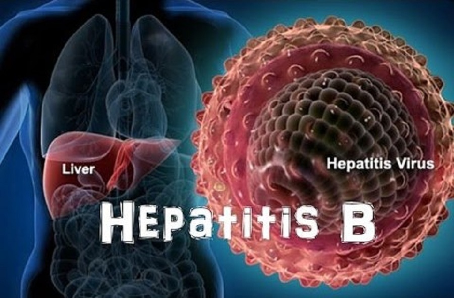 Hepatitis b