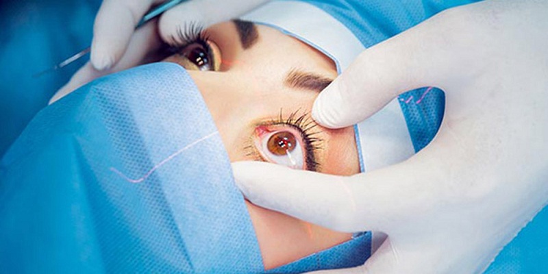 Eye surgery