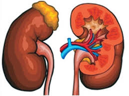 Kidney